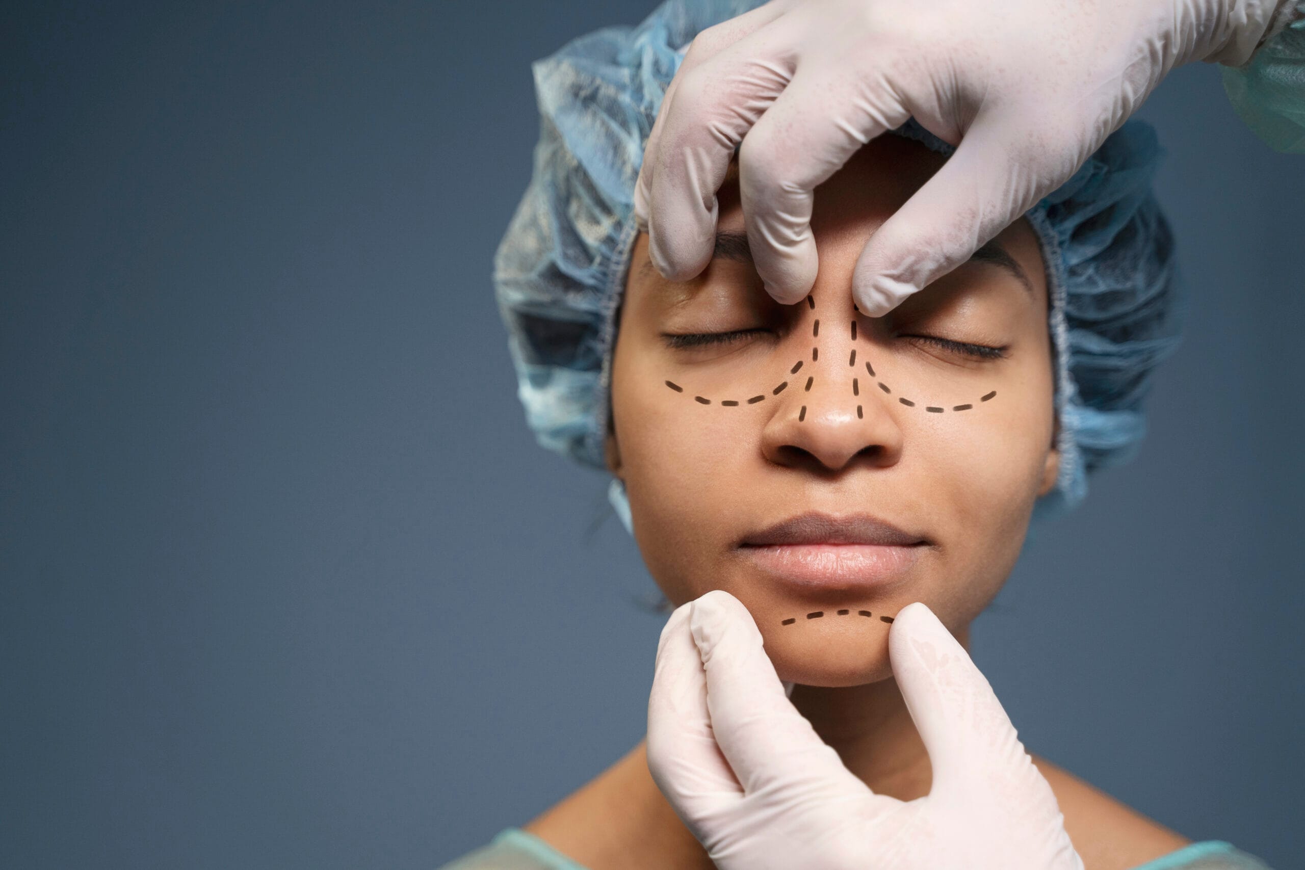 woman getting ready nose job surgery 1 scaled