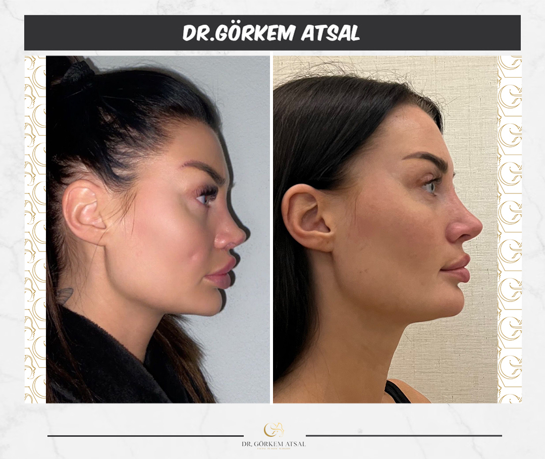 dr gorkem atsal