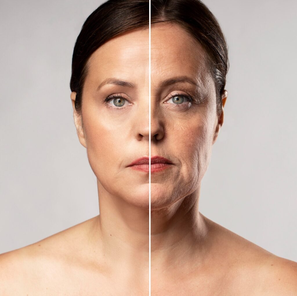 before after facelift
