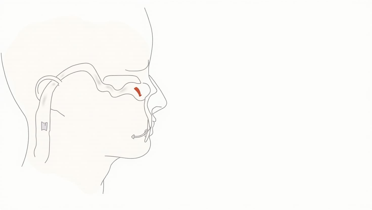 Balloon Sinuplasty Procedure Diagram